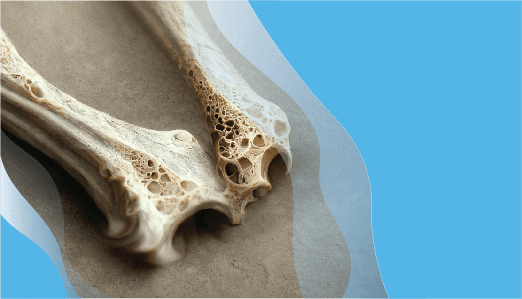 Bone cancer